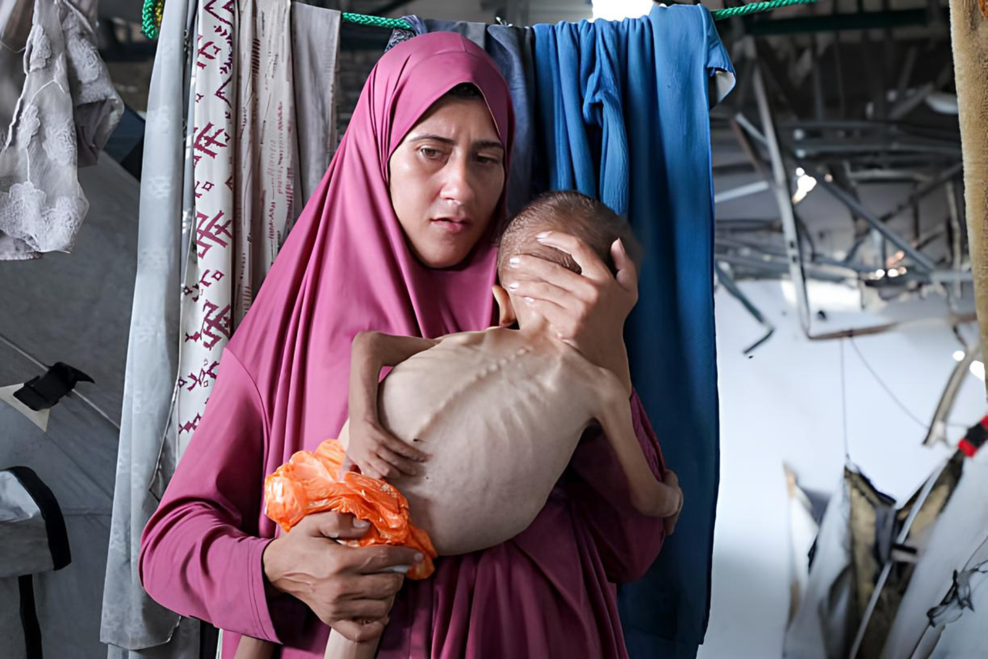 Gaza Berada dalam Kondisi Famine (Kelaparan Ekstrem)